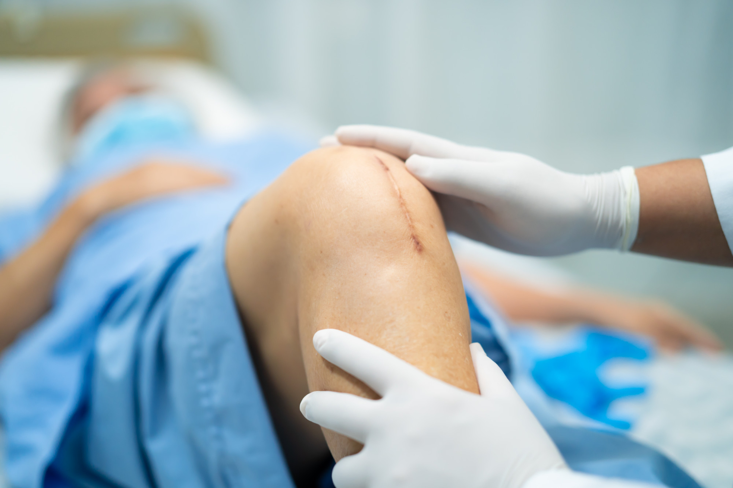 Joint Preservation Surgery
